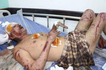 Saudi Massacres in Yemen Continue Claiming more Martyrs in Hodeida and Sanaa