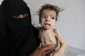 Yemeni starved kid held by his helpless mother