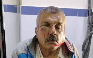 Palestinian man assaulted