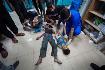EDITORS NOTE: Graphic content / TOPSHOT - Injured Palestinians are transported to the Al-Aqsa Martyrs Hospital in Deir al-Balah following Israeli bombardment of al-Bureij in the eastern Gaza Strip on May 21, 2024, amid the ongoing conflict between Israel and the militant group Hamas. (Photo by AFP)